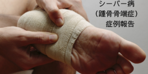 シーバー病（踵骨骨端症）