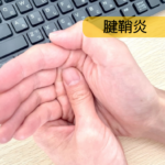 腱鞘炎